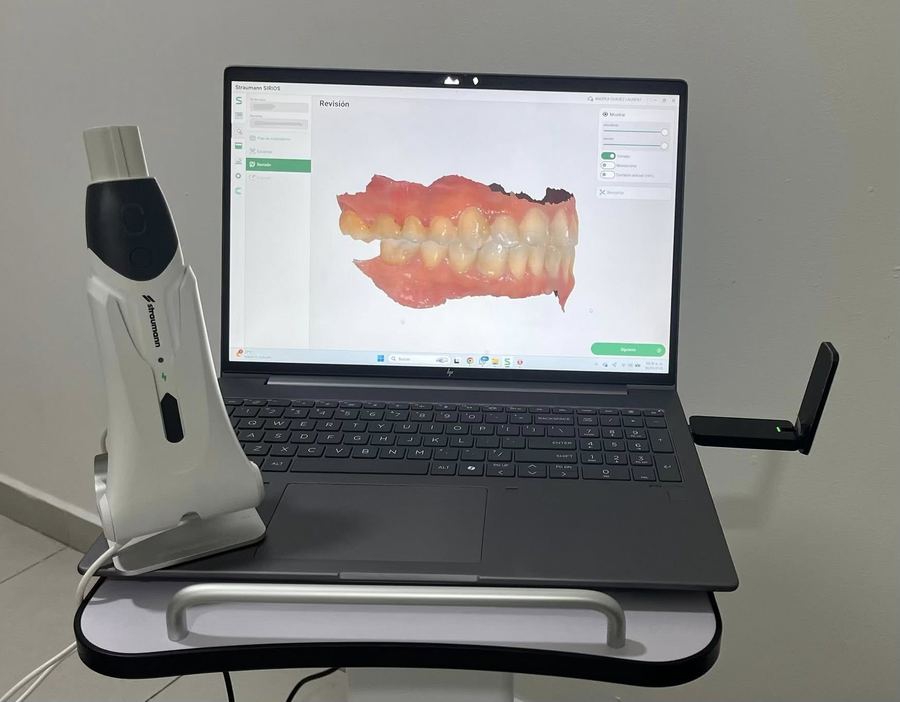 In-house digital dental lab with intraoral 3D scanner at Aurum Dental